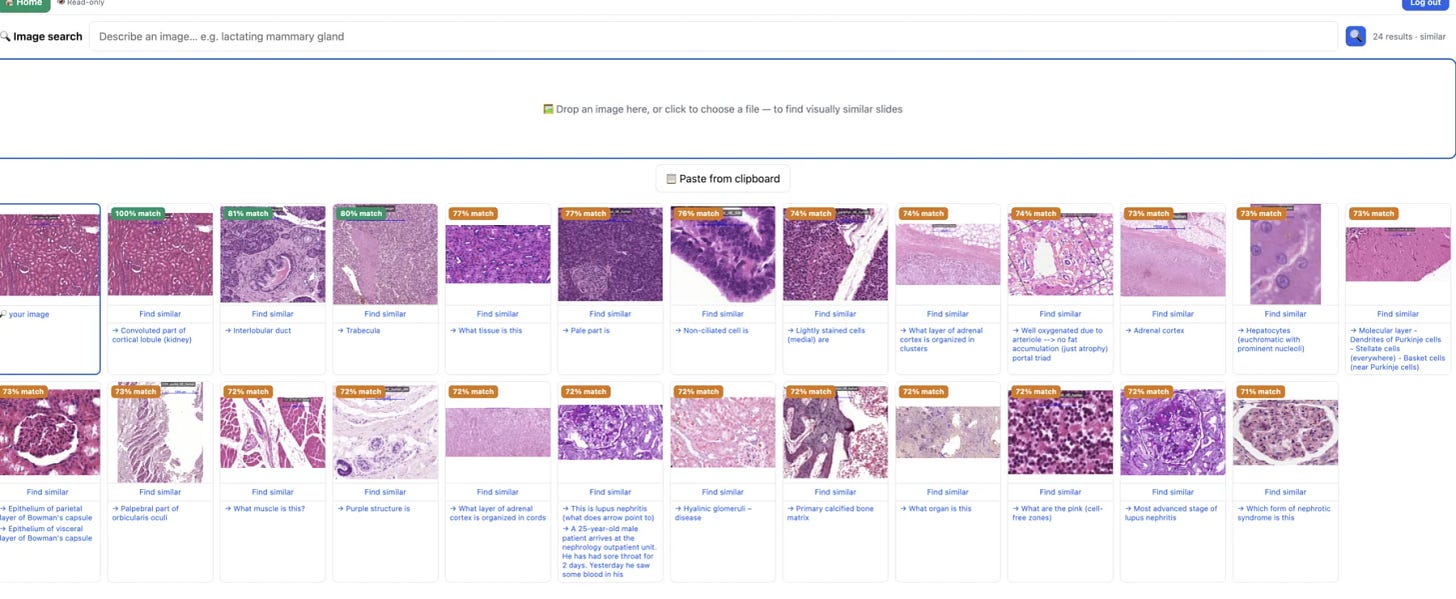 Study with Hannah semantic image search showing visually similar histology slides Study with Hannah semantic image search showing visually similar histology slides