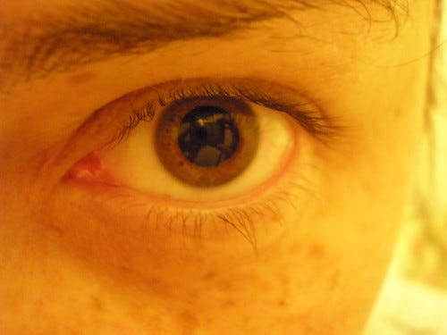 Dilated Eye Dilated Eye