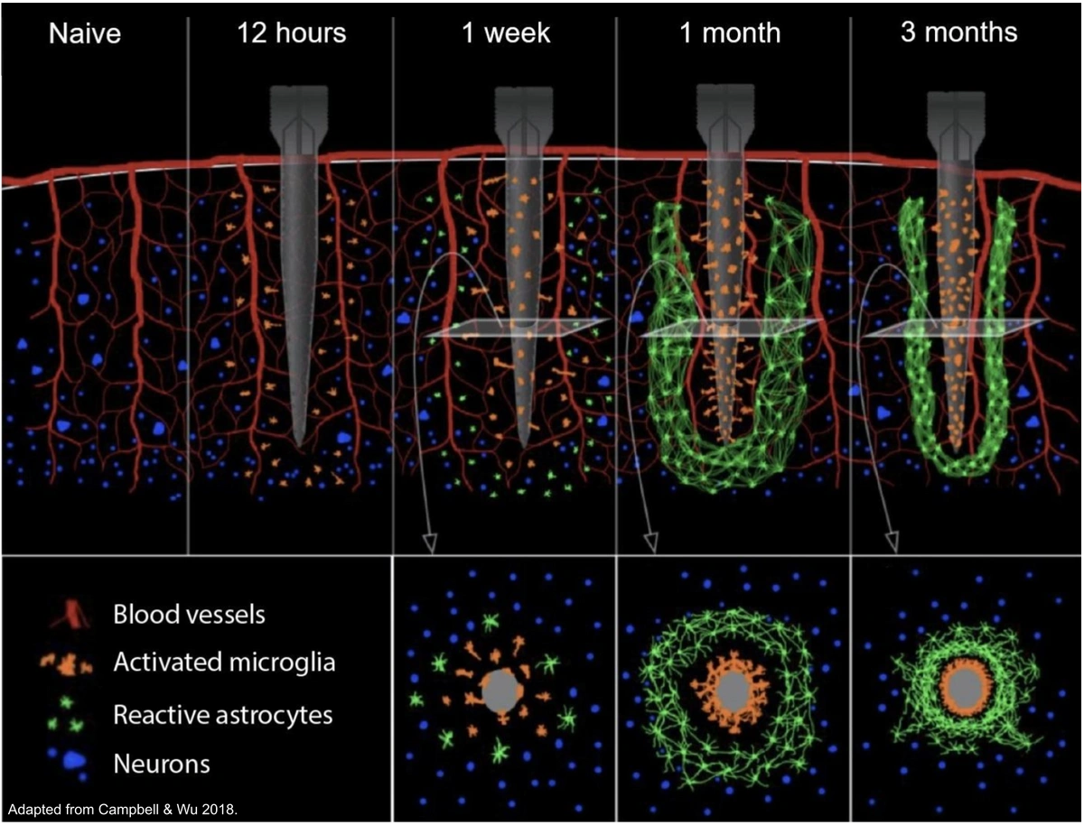 A multi-panel illustrative graphic showing the longitudinal development of glial encapsulation around a single electrode. In the top left is a graphic of naive tissue, showing blood vessels descending into the tissue and neurons throughout the tissue. The panels to the right of the naive panel show progressive increase and maturation of the glial capsule at 12 hours, 1 week, 1 month, and 3 months. Three additional illustrations, in a horizontal viewing plane, are located below the 1-week, 1-month and 3-month panels. The horizontal views highlight the two-part ring of cells that form around the probe, composed of an inner ring of microglia and outer ring of astrocytes.