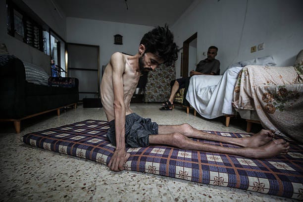 Year-old Khalil Muhammed Dervis, living in the Nuseirat refugee camp in the central part of the Gaza Strip, which is under Israeli blockade and...