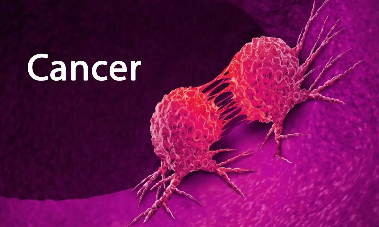 Un fármaco contra las náuseas puede ayudar a los pacientes con cáncer a sobrevivir más tiempo, según un estudio