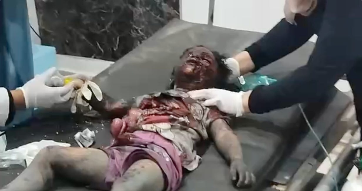 That's a sweet girl in Gaza, with her guts hanging out, burned, bloodied, breathing her last breaths before she passes from time back to eternity