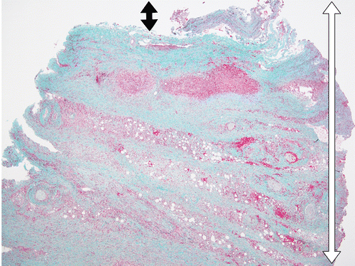 Figure 1b.