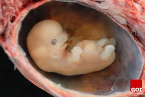 Embryo @ 6- 7 weeks