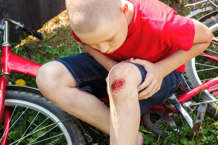 Image of Young White Boy in Red Shirt with Skinned Knee beside Red Bike on the Ground