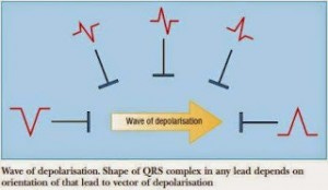 lead-diagram