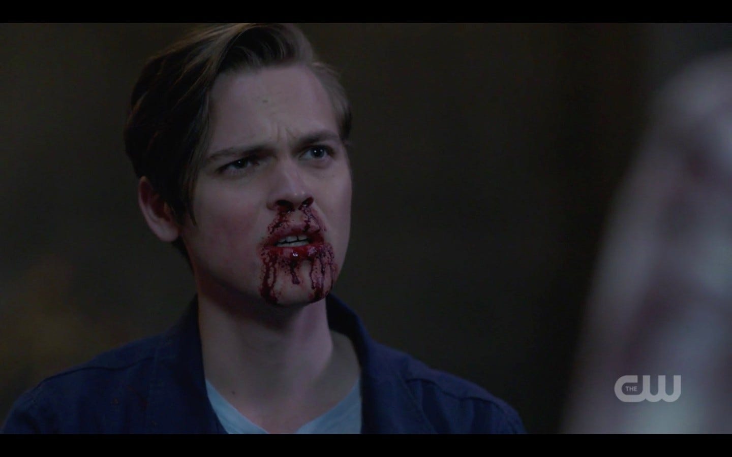 supernatural bloodied us jack look at sam winchester 1324 supernatural bloodied us jack look at sam winchester 1324