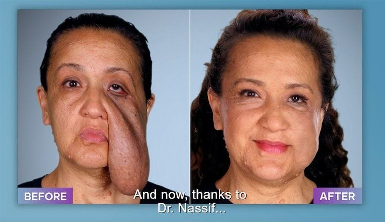 Botched 820