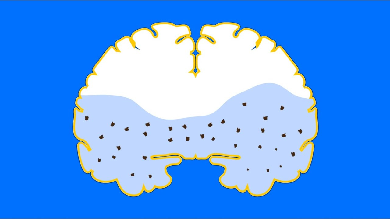 What Sleep Does to Your Brain What Sleep Does to Your Brain