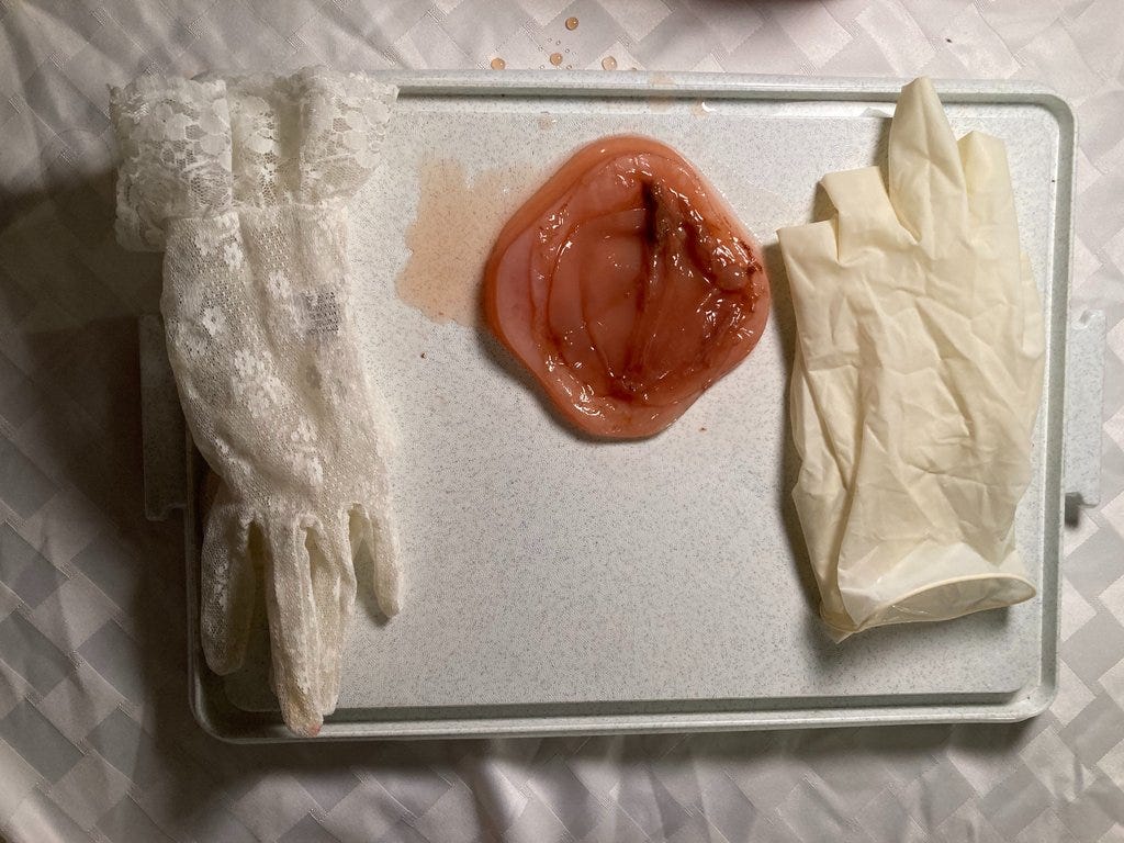 A Material Exploration of SCOBY