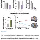 Accelerated dTMS in Alcohol Use Disorder and "Very Treatment Resistant" Depression