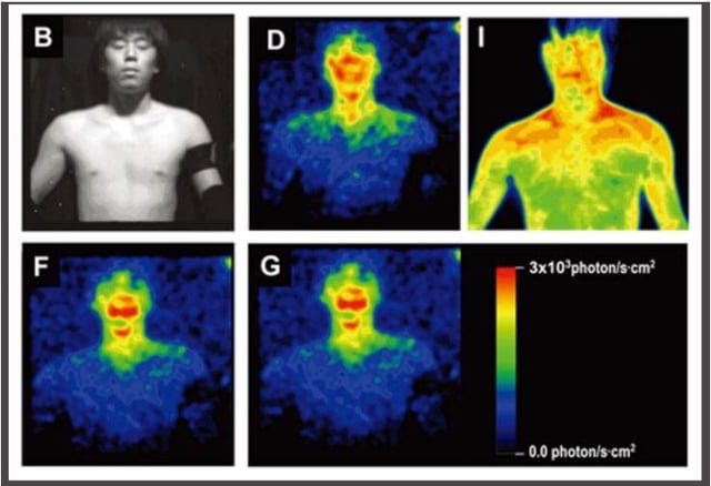 The human body glows—literally—but our eyes aren't sensitive enough to see  it. This phenomenon is called biophoton emission or ultra-weak photon  emission (UPE). It refers to the very low levels of visible