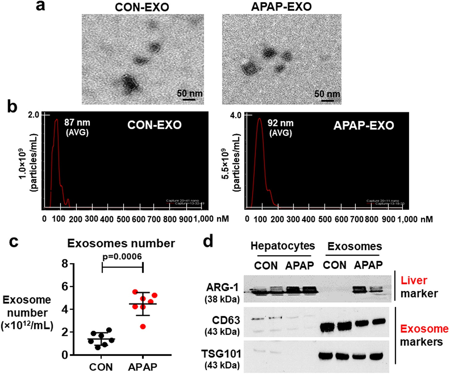Figure 2 from the 2018 Scientific Reports study: electron micrographs and size distributions of control and acetaminophen-derived exosomes, with exosome counts and marker blots Figure 2 from the 2018 Scientific Reports study: electron micrographs and size distributions of control and acetaminophen-derived exosomes, with exosome counts and marker blots