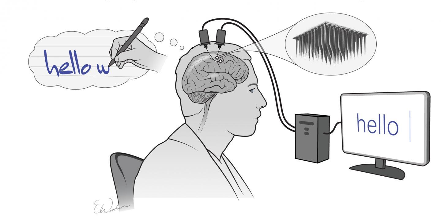 Novo interface cérebro-computador transforma “escrita mental” em texto num  ecrã | Tecnologia | PÚBLICO