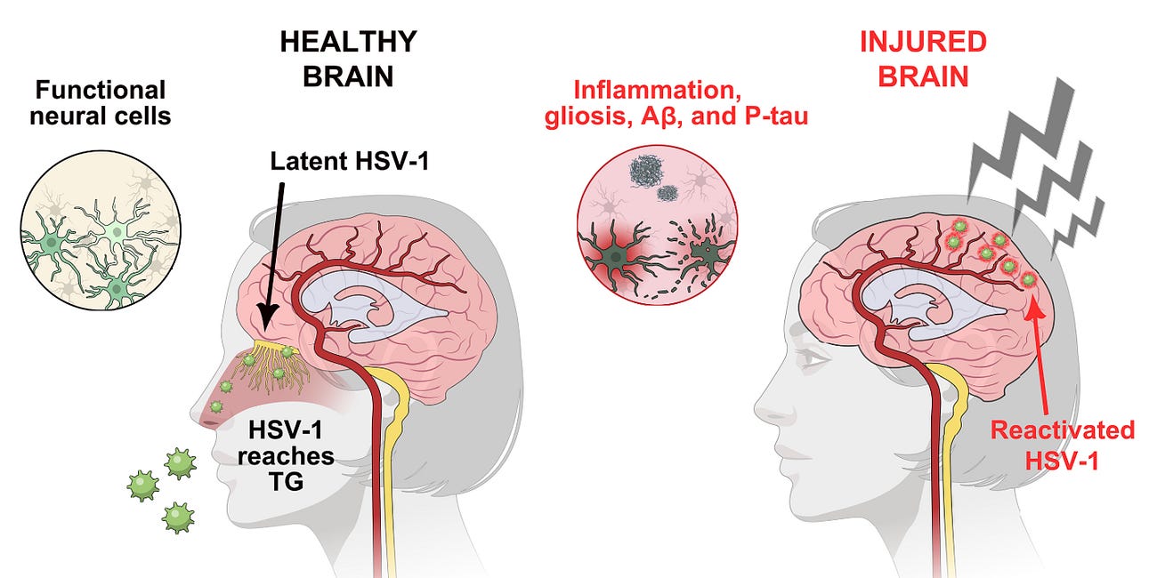 We may already have the first Alzheimer's Vaccines