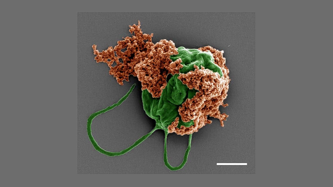 Colored scanning electron microscope image of a microrobot made of an algae cell (green) drug-filled nanoparticles (orange) coated with red blood cell membranes