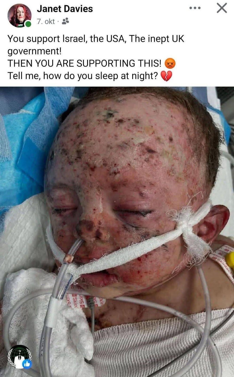 May be an image of hospital and text that says "Janet Davies 7. okt You support Israel, the USA, The inept UK government! EN YOU ARE SUPPORTING THIS! Tell me, how do you sleep at night? Skistae PISE SkIn うめ Skin 5. INSE ត្រោ CR"
