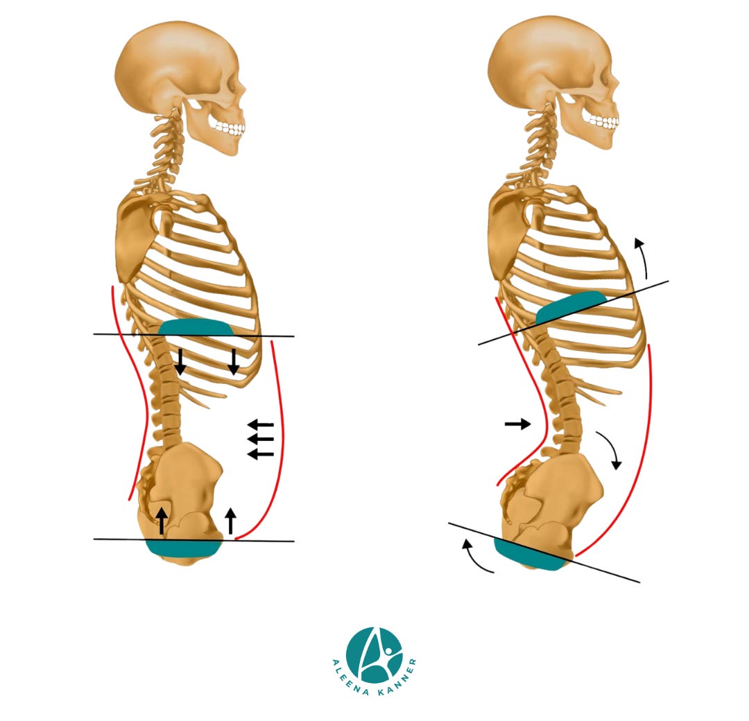 Neck Out Forward Forward Head Posture: Why Your Neck Pain Isn’t Just About the Neck