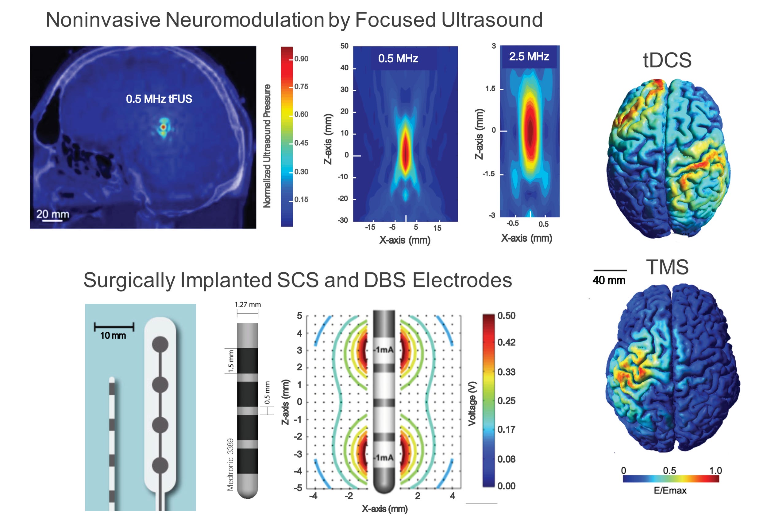 How Ultrasound Neuromodulation Works - by Sarah Constantin