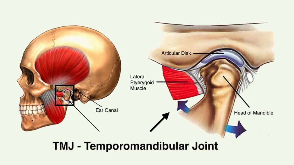 What is Displaced Articular Disc TMJ Disorder? | Dr. Larry M. Wolford, DMD