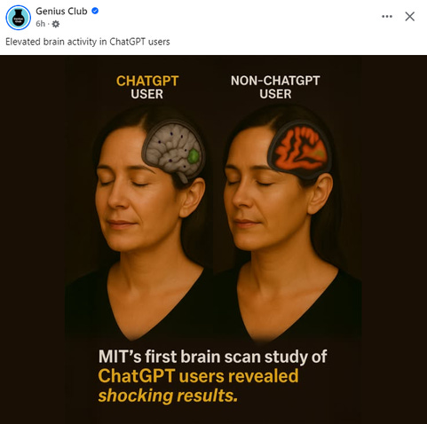 A 'Genius Club' Facebook post declaring 'Elevated Brain activity in ChatGPT users', with an image of the same woman, doubled, side by side, with a section missing from her skull to reveal the brain underneath.The 'ChatGPT user' has a healthy-looking grey brain (but with several evenly-spaced holes in it, for some reason) with a glowing green blob around the junction between the occipital and temporal lobes.The 'non-ChatGPT user' seems to have a red coloured brain presented in lower resolution, with massively enlarged ventricles more typically seen in advanced dementia or other global neurodegenerative conditions, with a subtler green blob in the same place. A 'Genius Club' Facebook post declaring 'Elevated Brain activity in ChatGPT users', with an image of the same woman, doubled, side by side, with a section missing from her skull to reveal the brain underneath.The 'ChatGPT user' has a healthy-looking grey brain (but with several evenly-spaced holes in it, for some reason) with a glowing green blob around the junction between the occipital and temporal lobes.The 'non-ChatGPT user' seems to have a red coloured brain presented in lower resolution, with massively enlarged ventricles more typically seen in advanced dementia or other global neurodegenerative conditions, with a subtler green blob in the same place.
