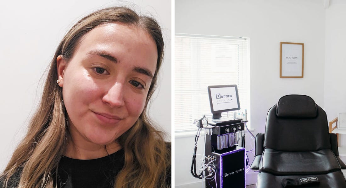 I had a game-changing facial at a salon in Radcliffe on Trent — my skin has never looked better