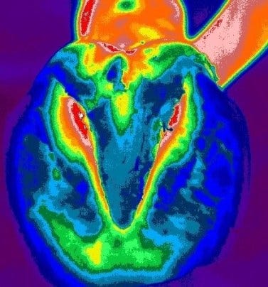 Thermal imaging horse hoof