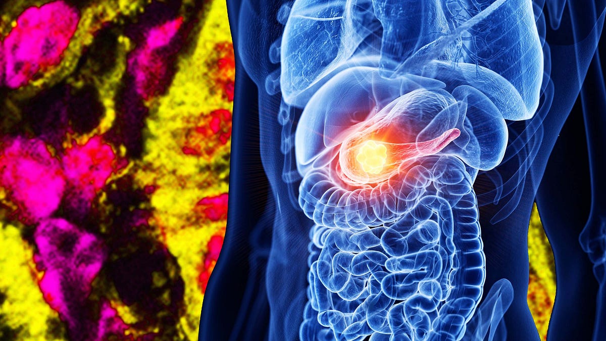 The Cancer Research Machine Trump Is Gutting Just Delivered a Big Breakthrough