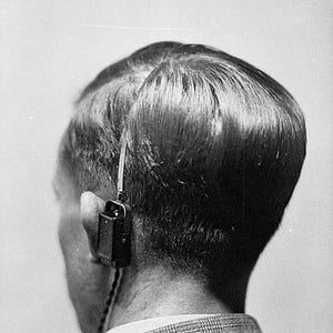 I Got Surgery to Restore My Hearing. I Regret It.