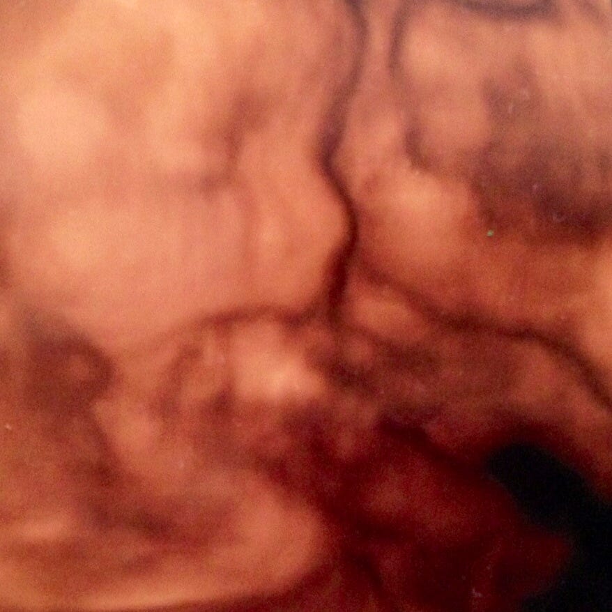 Sidewalk Help and more 