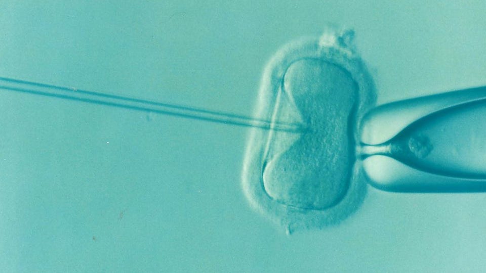 File:Ivf.png