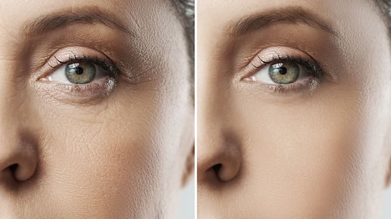 how your diet shapes the way your skin ages