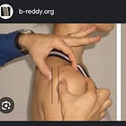 Solving front of the shoulder pain