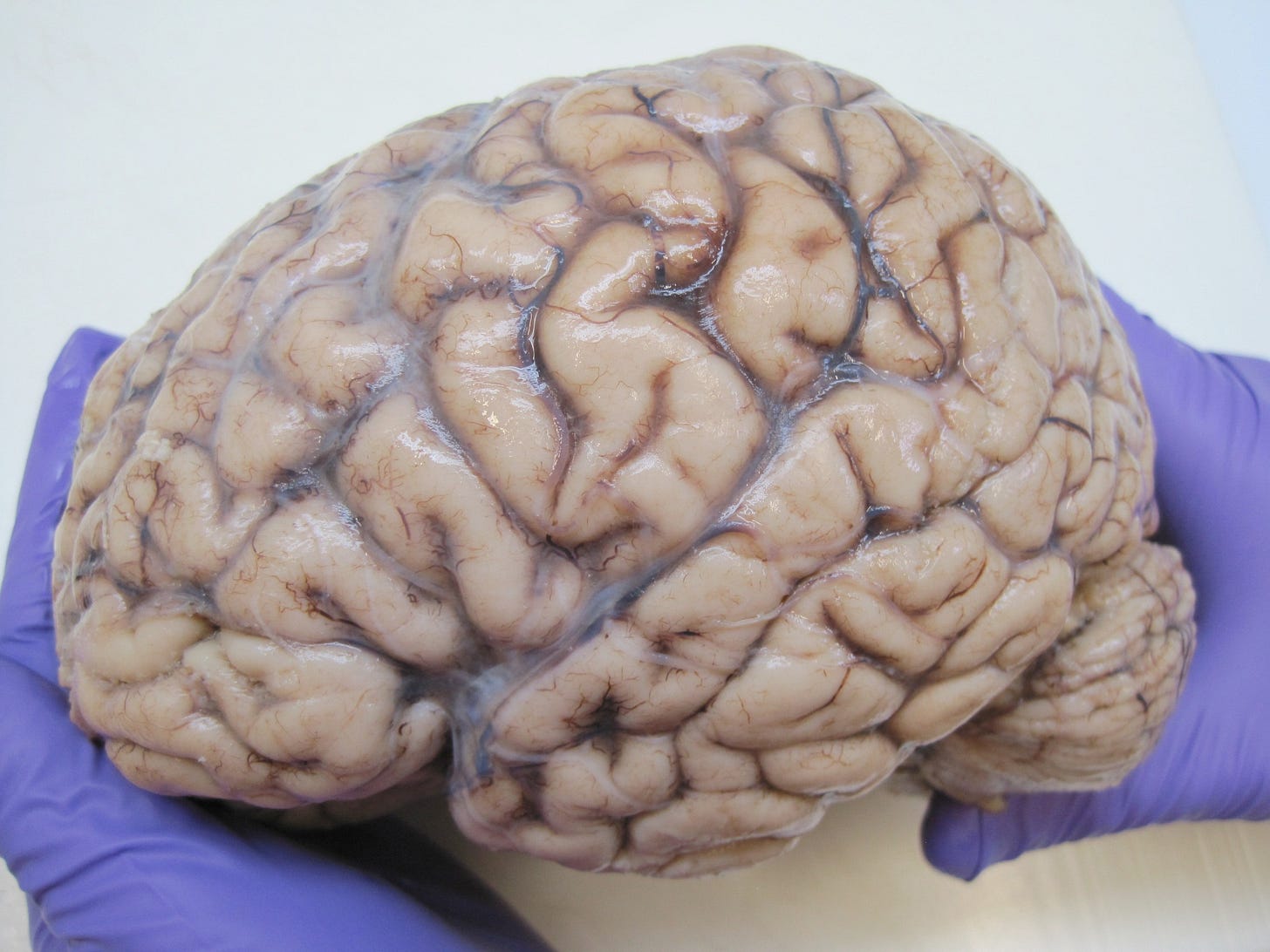 Picture of real human brain