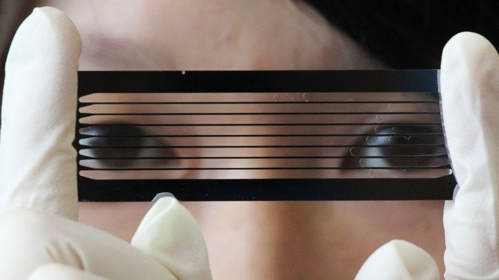 DNA sequencing has made it possible to conduct genetic diagnosis of inherited, although often rare, diseases (Credit: Dickson Lee/Getty Images) DNA sequencing has made it possible to conduct genetic diagnosis of inherited, although often rare, diseases (Credit: Dickson Lee/Getty Images)