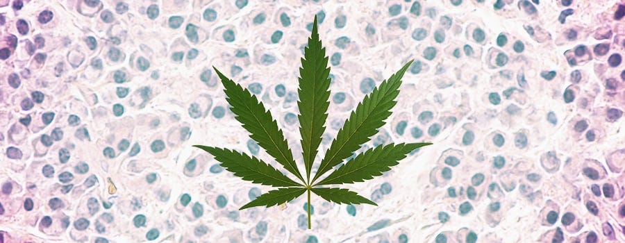 Can Cannabis Help To Treat Leukaemia? - RQS Blog Can Cannabis Help To Treat Leukaemia? - RQS Blog