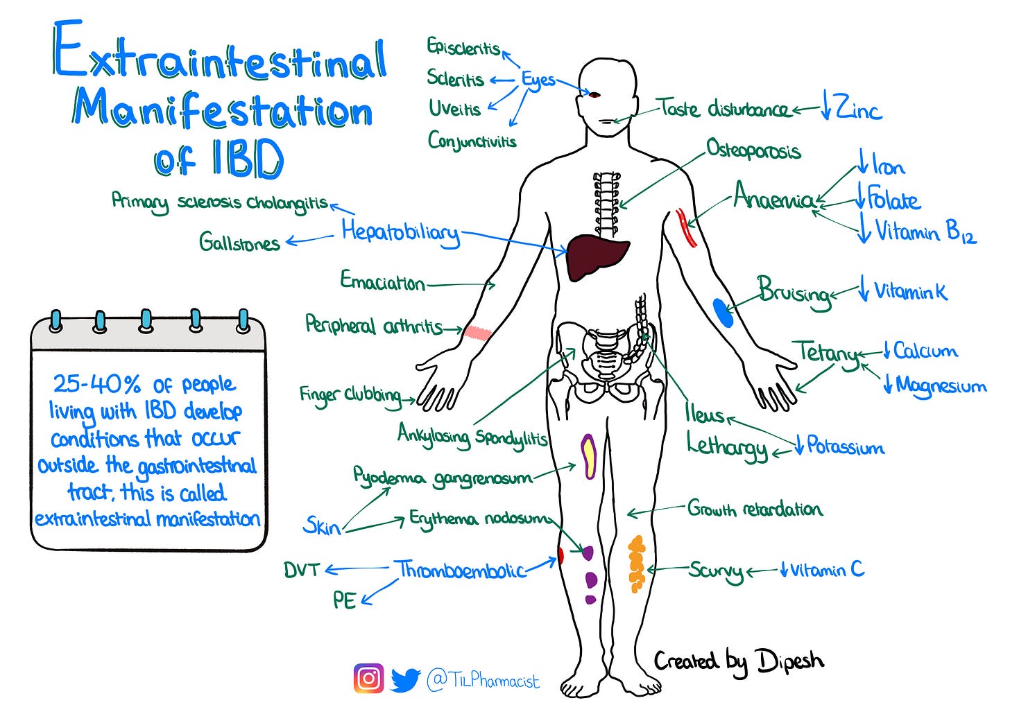 Extraintestinal manifestation of IBD, from TILpharmacist Extraintestinal manifestation of IBD, from TILpharmacist