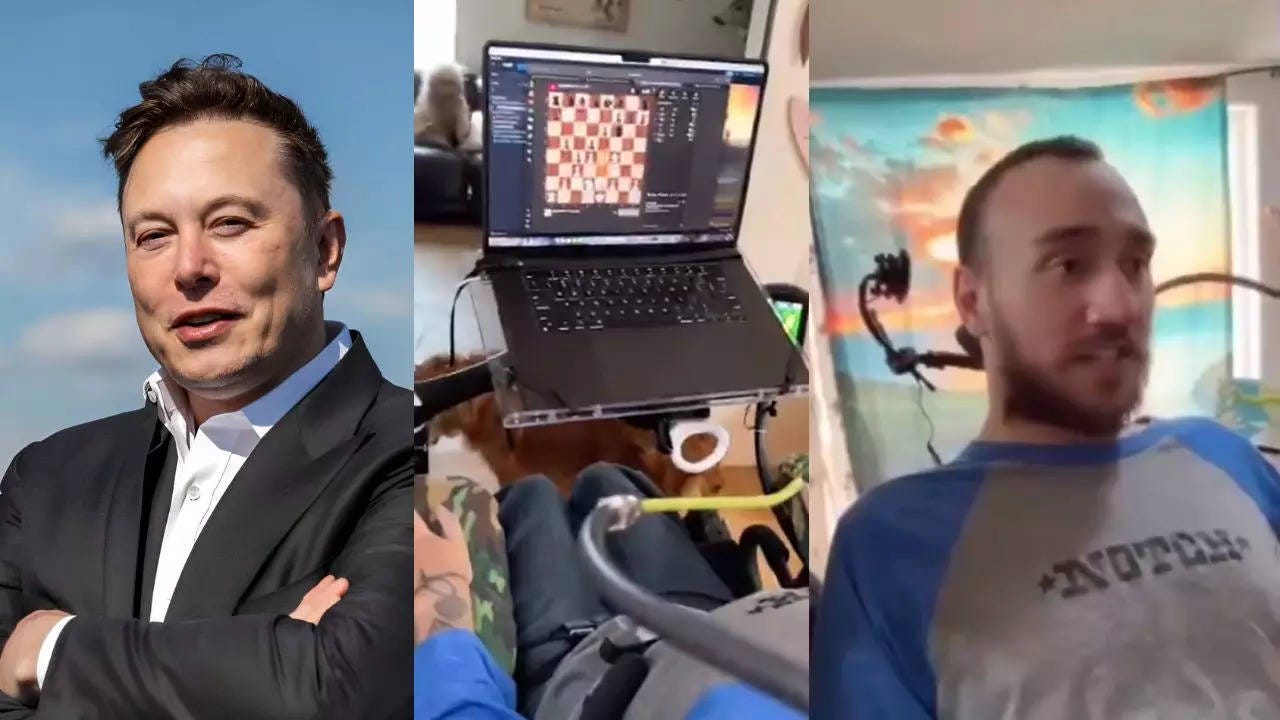 Noland Arbaugh: Meet Noland Arbaugh, Neuralink's First Human Trial Patient  | US News News - Times Now