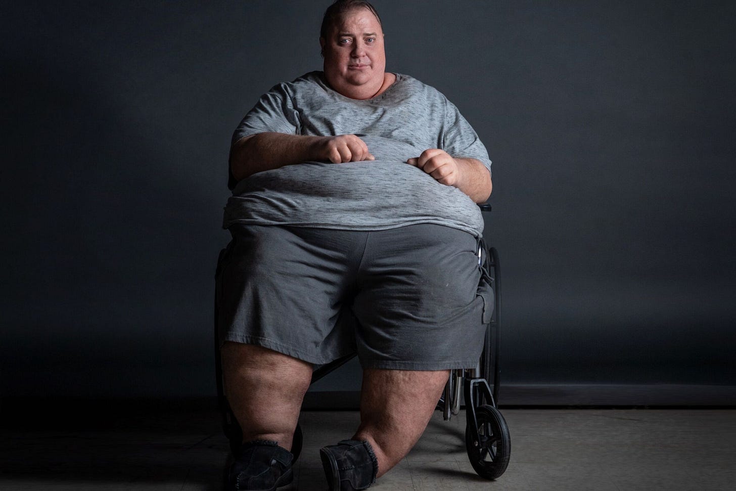 How 'The Whale' prosthetics blaze new trails with technology - Los Angeles Times How 'The Whale' prosthetics blaze new trails with technology - Los Angeles Times