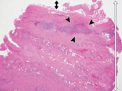 Figure 1a.