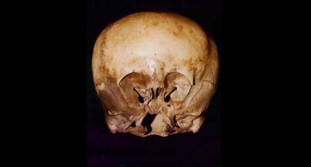 The Starchild Skull was first discovered in Mexico. (Fair use) The Starchild Skull was first discovered in Mexico. (Fair use)