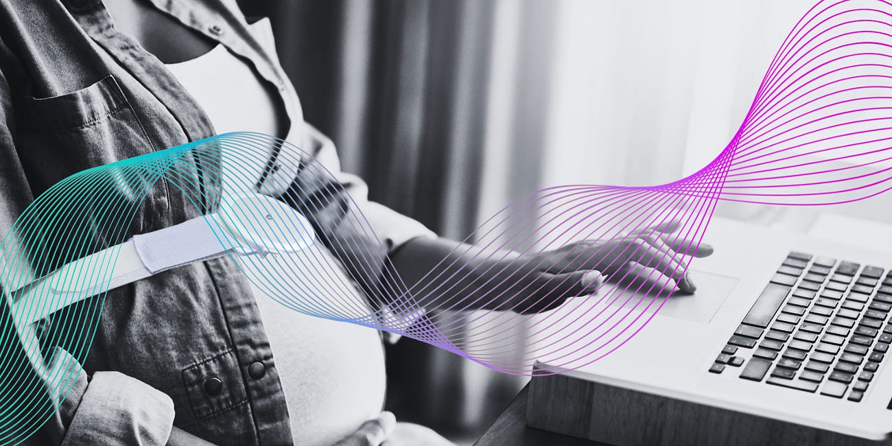 The Pregnancy Tech Revolution: Advancements Improving Maternity Wear