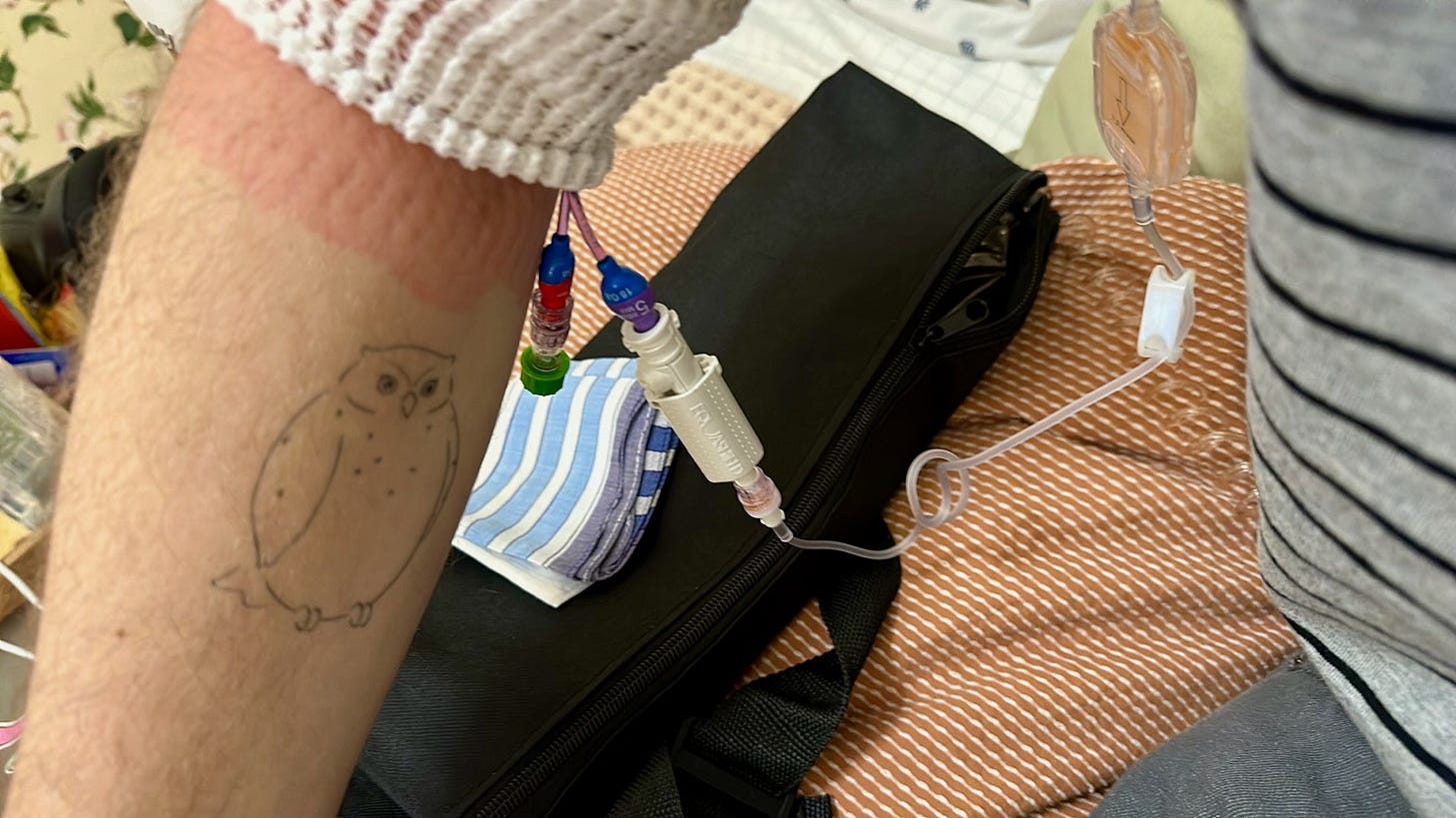 a photo of an arm with an owl tattoo connected by a tube to a black bag