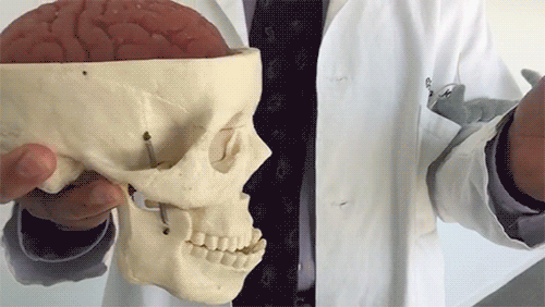 This is your brain experiencing a concussion : r/gifs