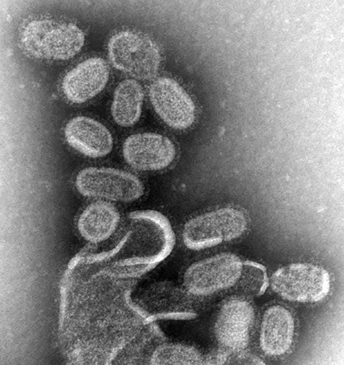 Influenza - Wikipedia