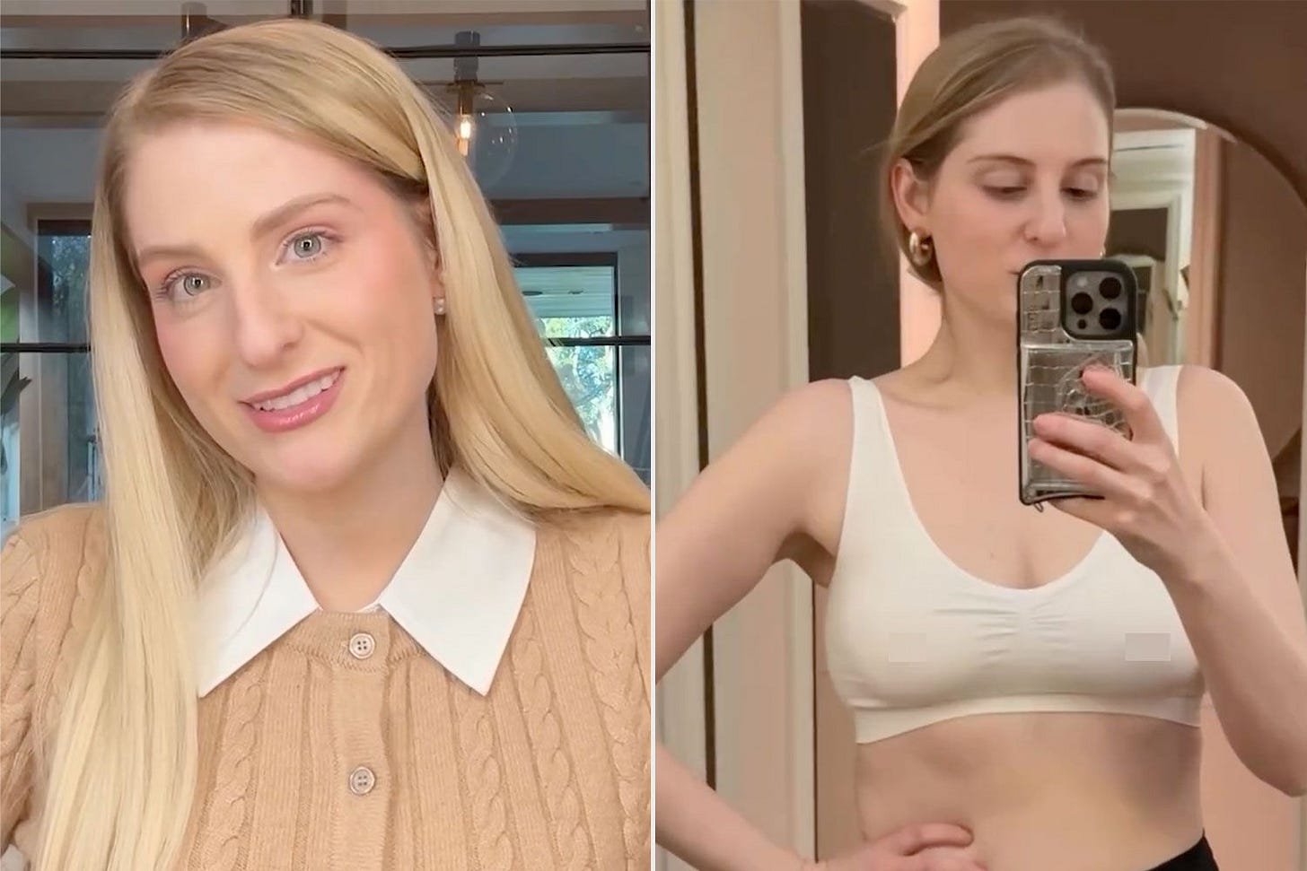 Meghan Trainor Details Her Breast Augmentation That Gave Her the 'Boobs of  My Dreams' (Exclusive)