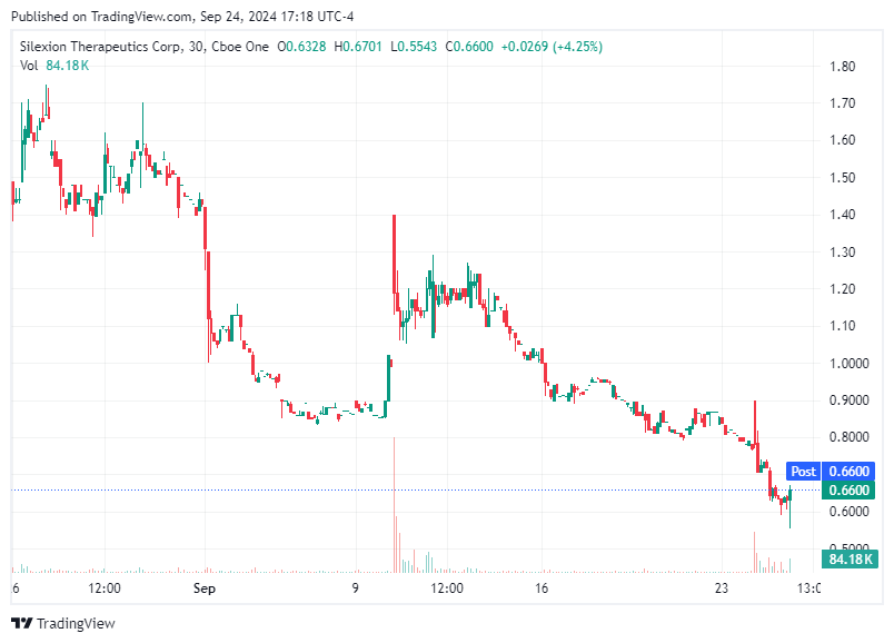 TradingView chart TradingView chart