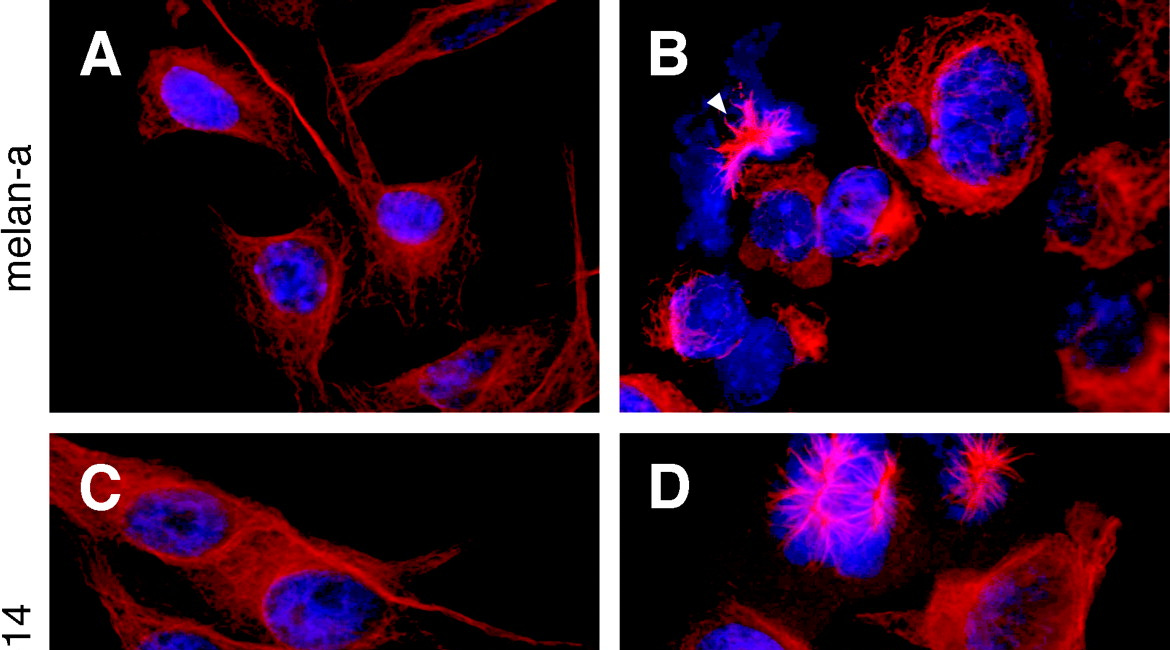 Ivermectin and Fenbendazole Success Stories: Tumors, Melanoma & Chronic Lymphocytic Leukemia
