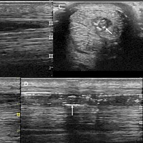 EVJ sounds out progress in treatment of tendon and ligament injuries