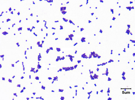 gram positive bugs under the microscope